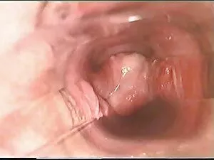 レイチェル-グレイハウンド-1年シビアン ...